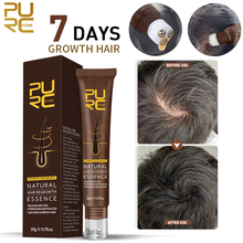 Ronquina Purc-productos de crecimiento rápido del cabello para hombres y mujeres...