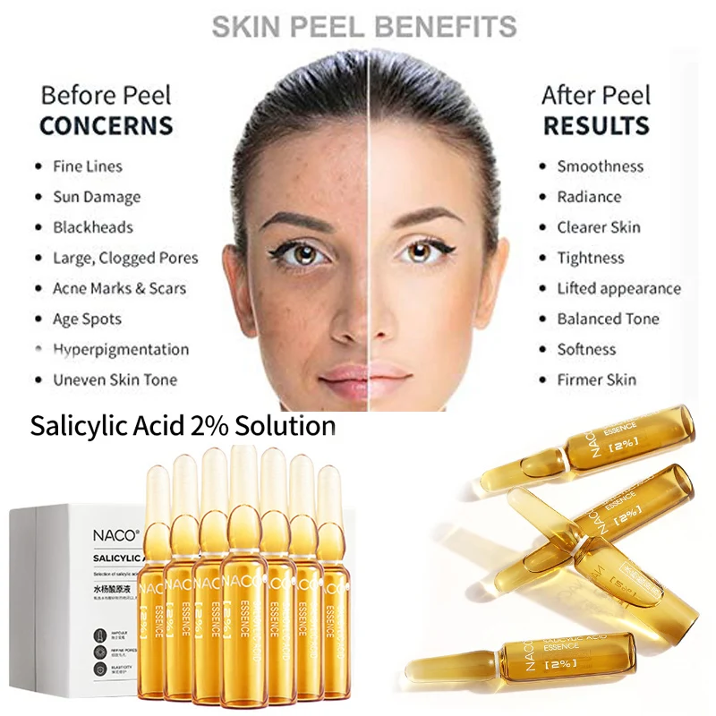Отбеливающая отбеливающая Сыворотка для лица 2% раствора салициловой кислоты