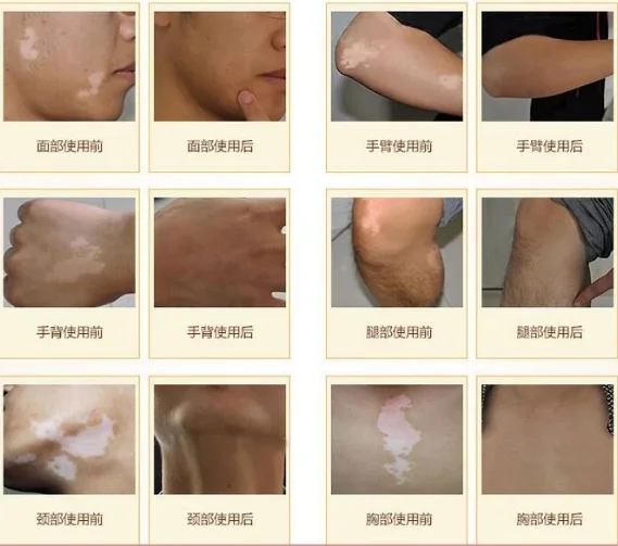 

White Concealer Pen Waterproof Covering Cream Skin Care For Concealer Fine And Smooth Beauty Tools 9g