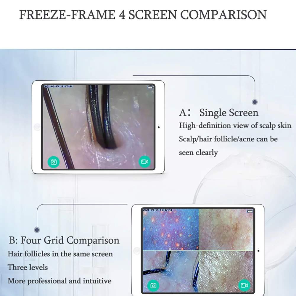 Новинка Wi-Fi HD телефон для кожи головы/кожи/волос перезаряжаемый анализатор
