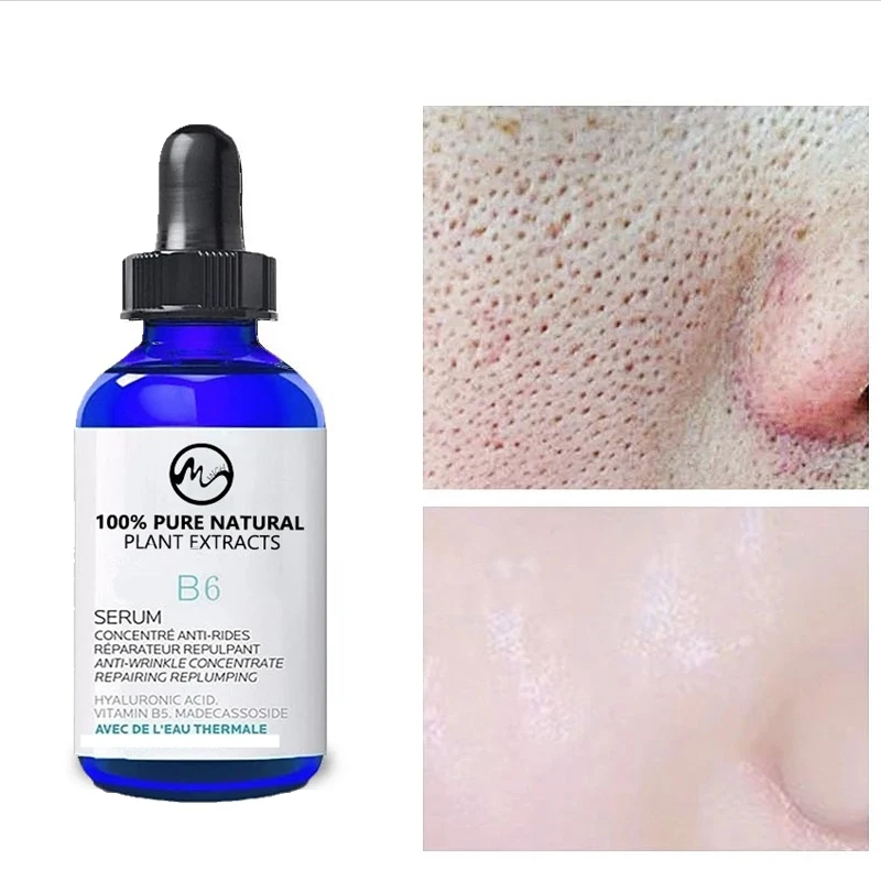Minch Vitamin B6 Face Serum Hyaluronic Acid Skin Oil 100% Pure Natural Anti-Aging Essence Organic Makeup Base Essential | Красота и