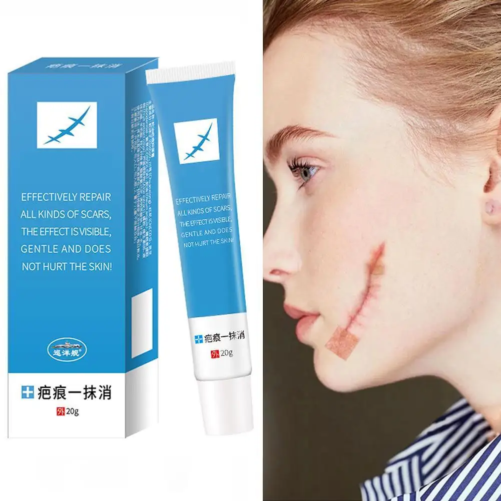 

20g Scar Acne Stretch Mark Removal Ointment Gel Cream Acne Cream Face For Face Scar Remover Repair Acne Spots Skin Removal A5B0