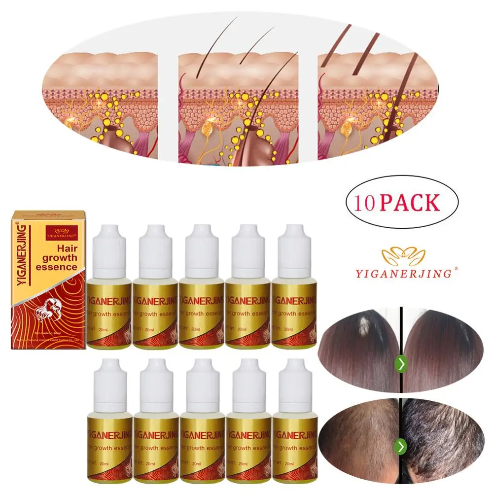 10PCS Экстракт имбиря, густые волосы, быстрая Защита от солнца, восстановление эссенции роста, YIGANERJING уход, масло, жидкая сыворотка для выпадения волос(20 мл - Цвет: 10PCS