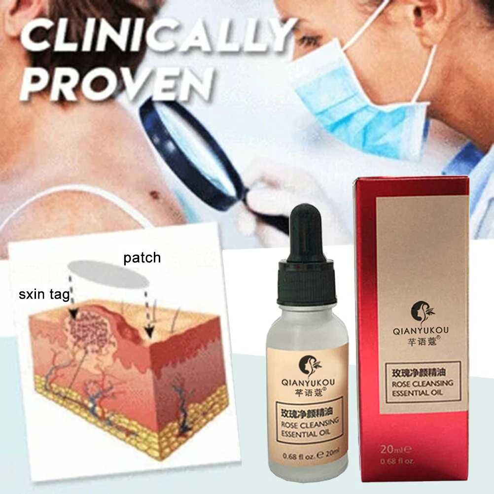 20 мл ручка для удаления кожных тегов 12 часов Tu Kill Medical Remover Skin Tag Mole & Genital средство