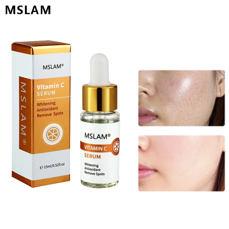 

Vitamin C Whitening Brighten Serum Remove Spots Fade Freckle Anti Wrinkle Face Care Improve Yellow Dark Skin Korean Cosmetics