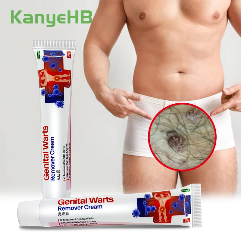 

2 шт., антибактериальная мазь для удаления бородавок на пенисе