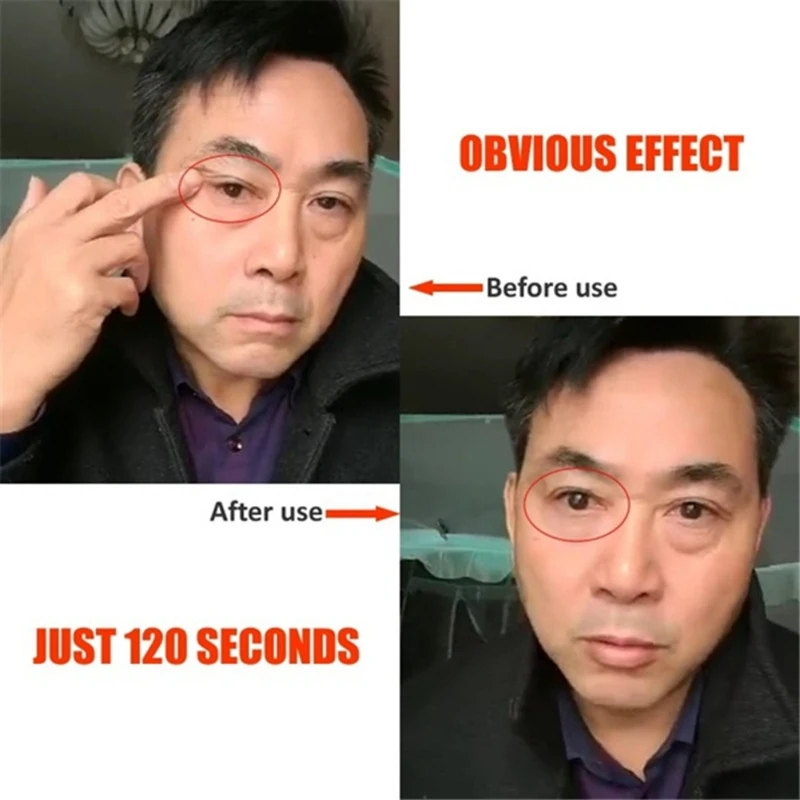 1 мл активным для ухода за областью вокруг глаз Удалить против мешков под глазами