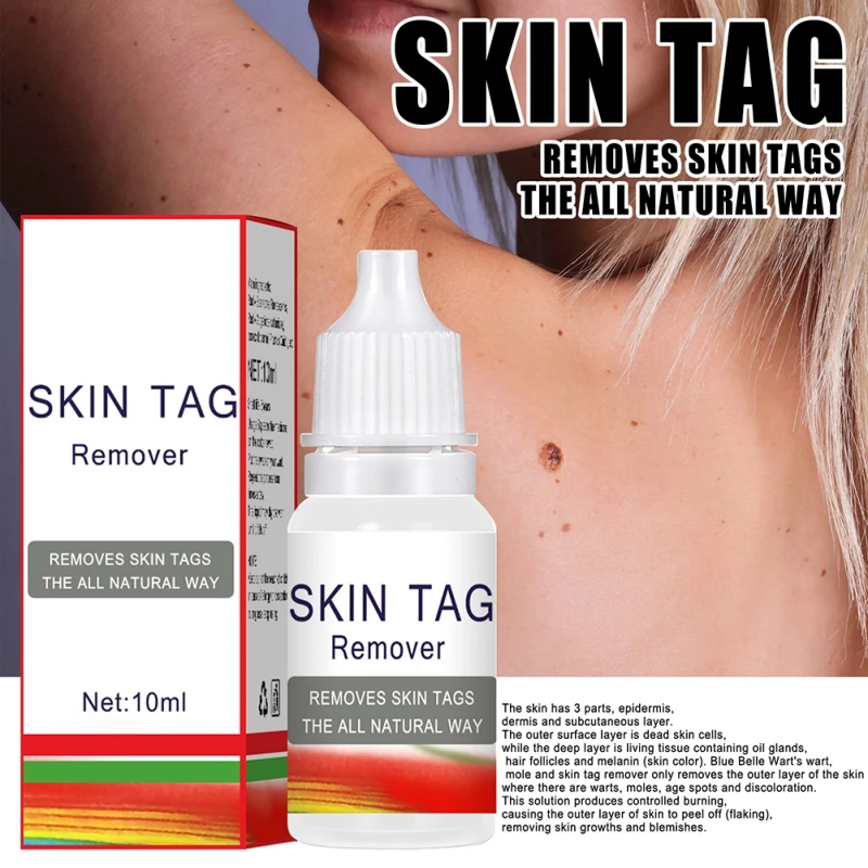 

Natural Formula Safe And Painless Wart Remover Liquid Skin Tag Remover 10ml Wart Removal Treatment for Men And Women