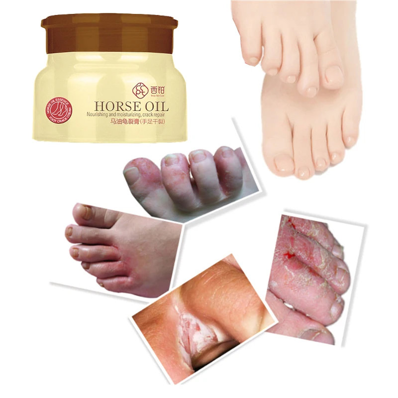 Крем крем для ног маска пятки от конского масла 80 г пузырьки против трещин пилинг