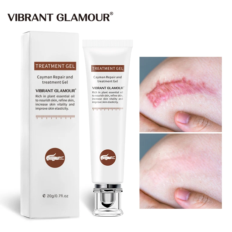 

VIBRANT GLAMOUR Repair Scar cream Removal Acne Scars Gel Stretch Marks Surgical Scar Burn Body Pigmentation Corrector Care 2pcs