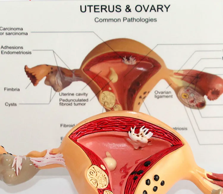 Манекены для медицинской тренировки анатомический скелет патологическая матка