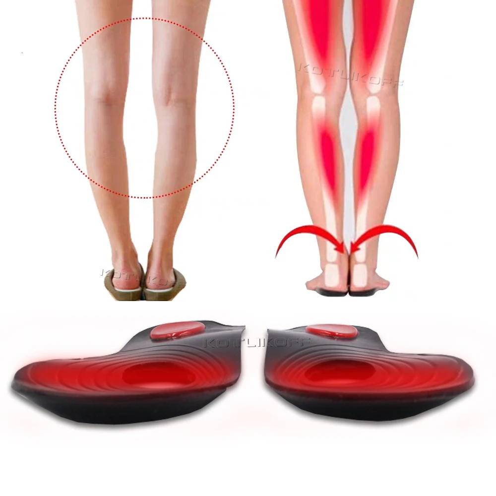 KOTLIKOFF ортопедические стельки O/X-Leg, Подошвенный Фасциит, супинатор, подстилки пятки, стельки, создающие красоту, уход за ногами