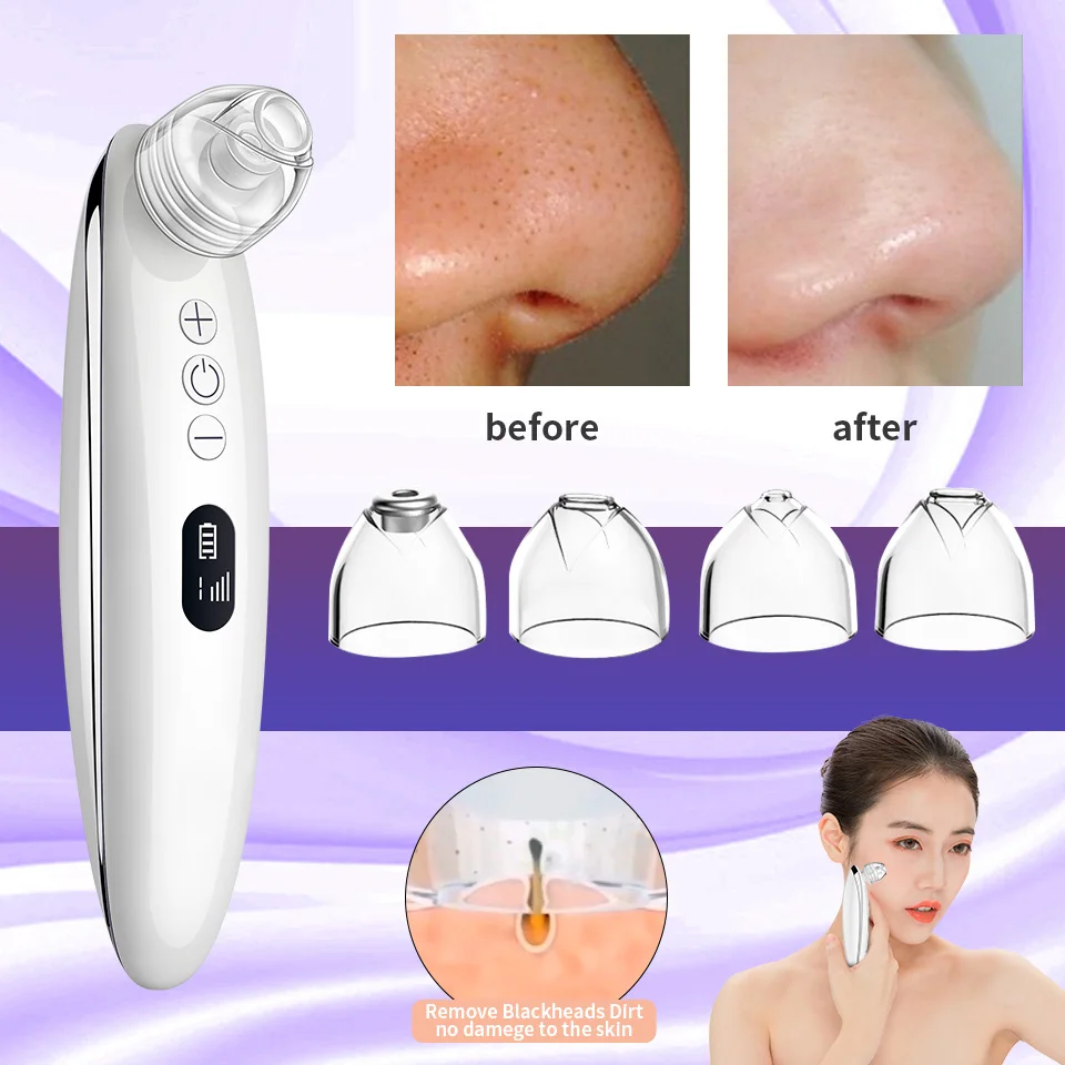 Средство для удаления черных точек на лице вакуумное устройство ухода за кожей