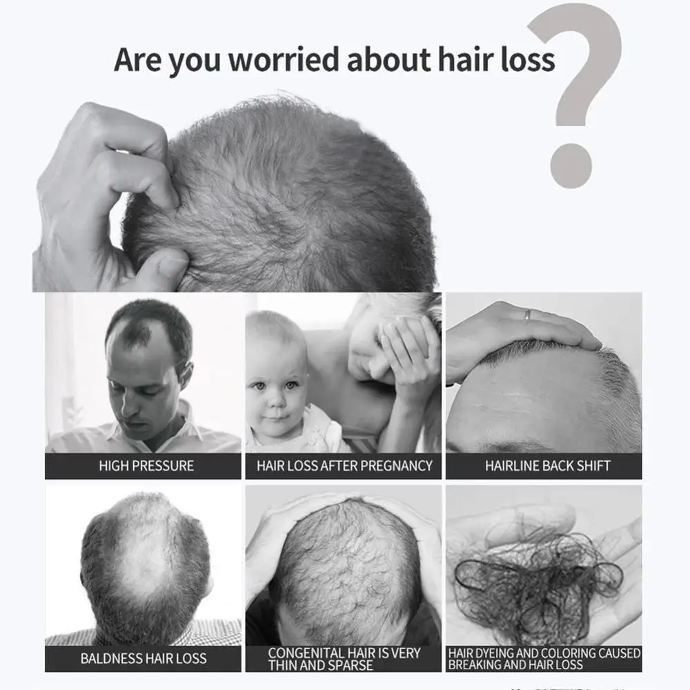 

Sevich 30Ml Plants Essence Hair Growth Spray For Hair Treatment Anti Prevent Hair Loss Product Hair Repair Grows Faster