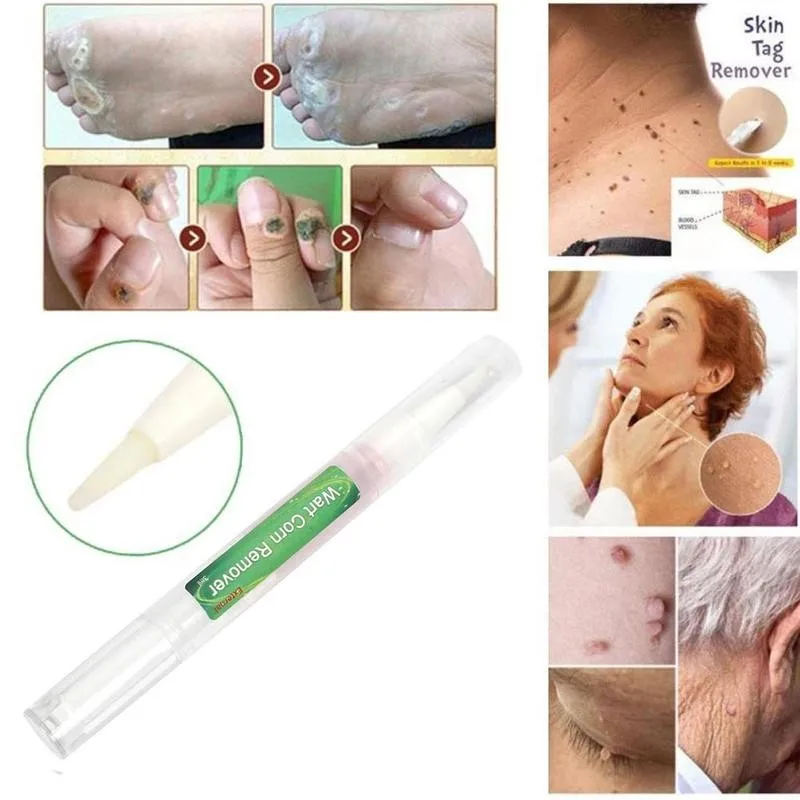 Жидкость для удаления бородавок мозолей папилломы | Красота и здоровье