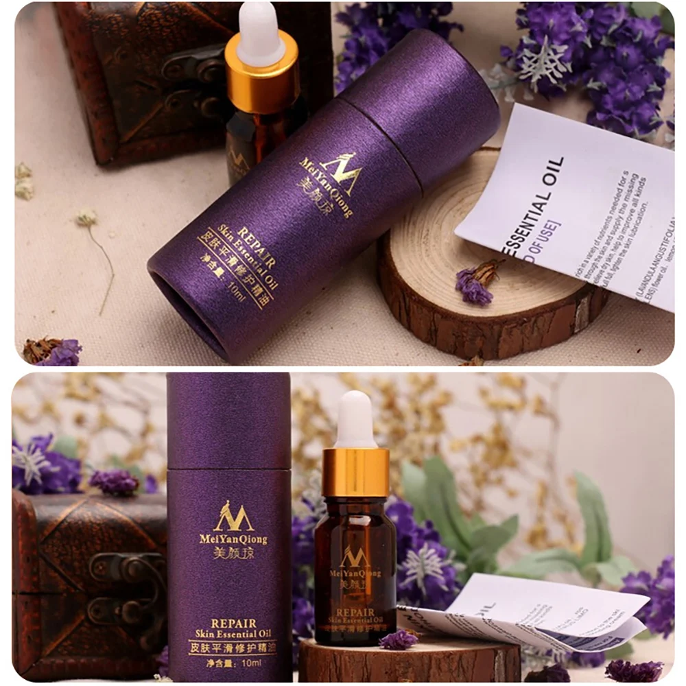 

MeiYanQiong Moisturizing Essence Natural Pure Massage Aromatherapy Scar Repair Skin Essential Oil Remove Burn Strentch Marks