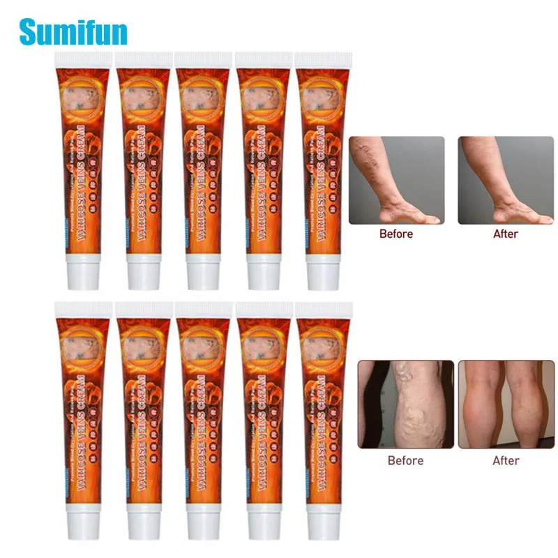 

Sumifun 10Pcs 20g Sumifun Varicose Veins Cream Chinese Herbal Medical Treatment Vasculitis Phlebitis Spider Pain Relief Ointment