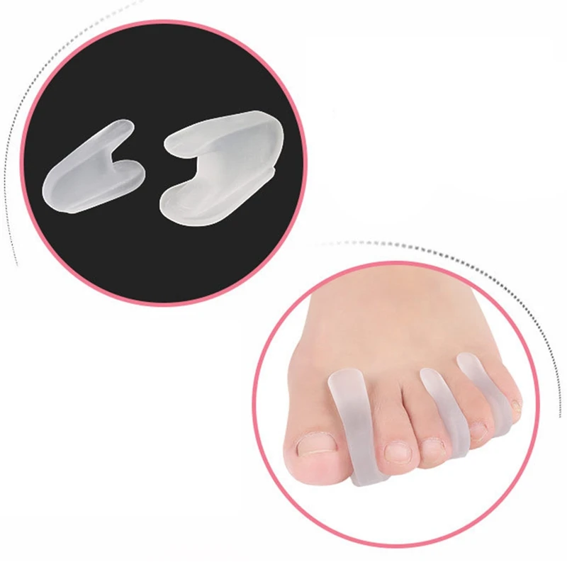 

1 пара А-образного разделитель для пальцев Thumb Valgus коррекция перекрещивающихся пальцев Correcttor облегчение боли силиконовый инструмент для ух...