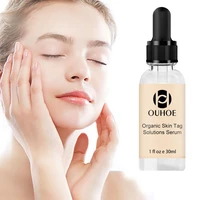 30ml no trace painle skin tag remover serum mole removal cream painless face wart mole freckle