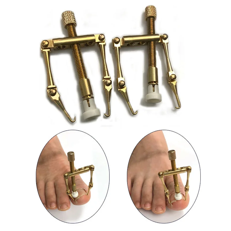 

Ingrown Toenails Correction Pedicure Foot Toe Nail Care Tools Elastic Patch Straightening metal Clip Brace Corrector Wire Fixer