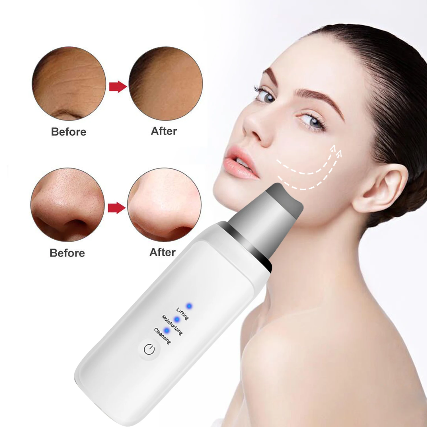 

Ultrasonic Skin Scrubber Deep Face Cleaning Machine Peeling Shovel Facial Pore Cleaner Face Skin Scrubber Lift Machine