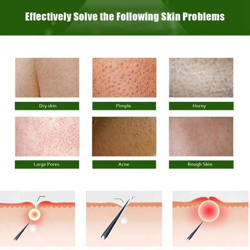 Отбеливающие эфирные масла для курицы 30 мл | Красота и здоровье