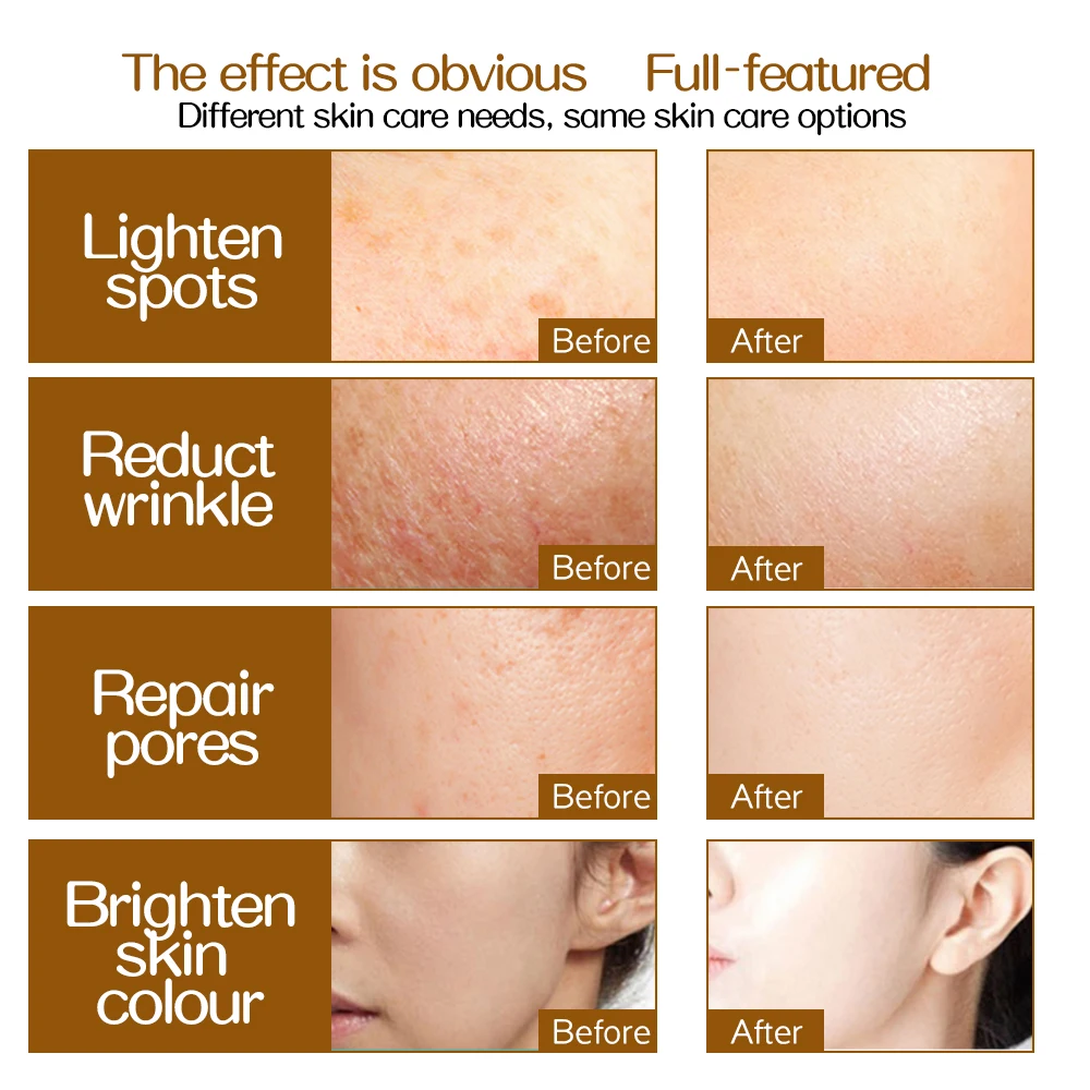 Титановые микро иглы ZGTS 192 дермароллер мезотерапия для ухода за лицом выпадение