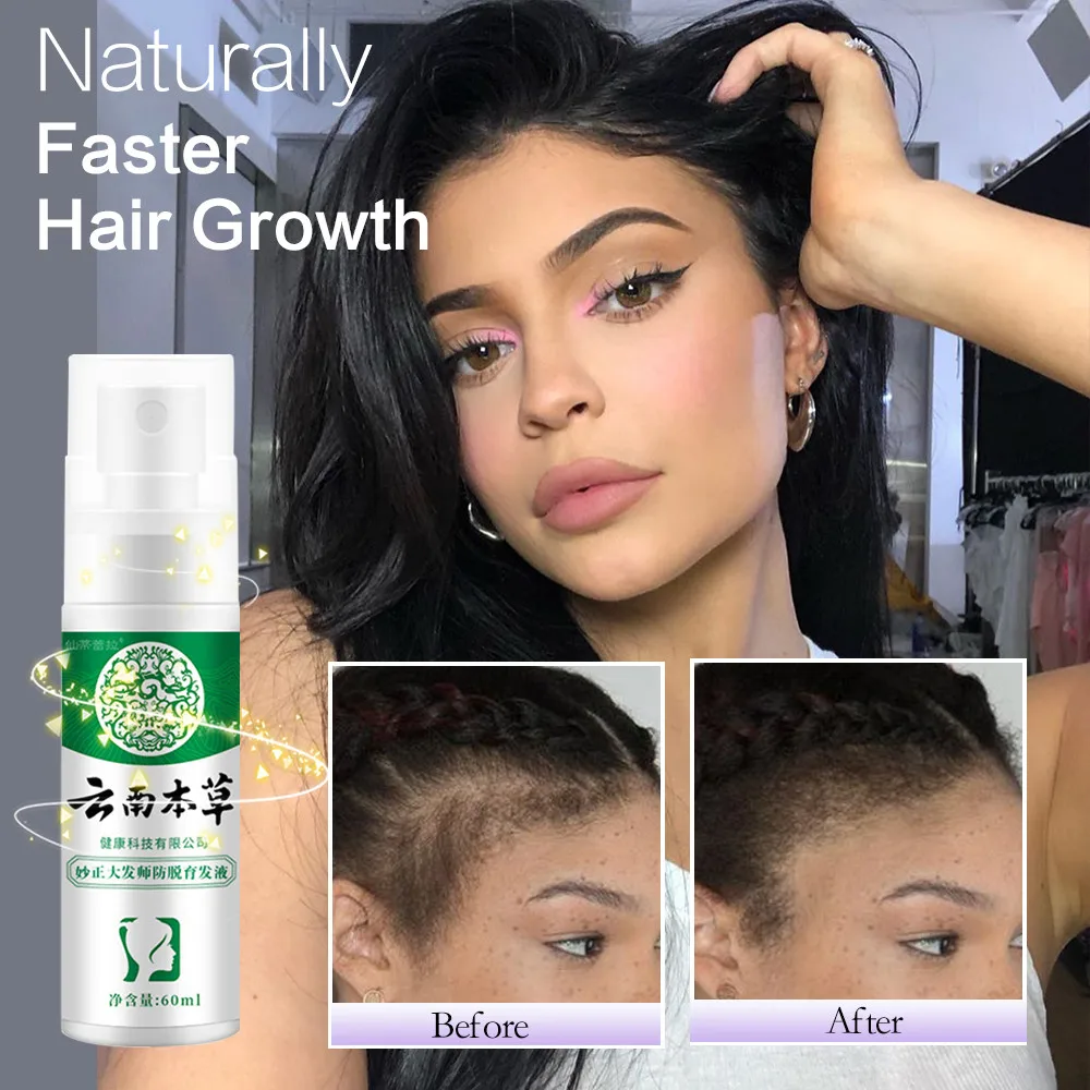 Эфирное масло для роста волос против выпадения мужчин t Масло жидкое спрей питает