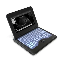 portable ultrasound system laptop ultrasound ce approved ultrasound scanner