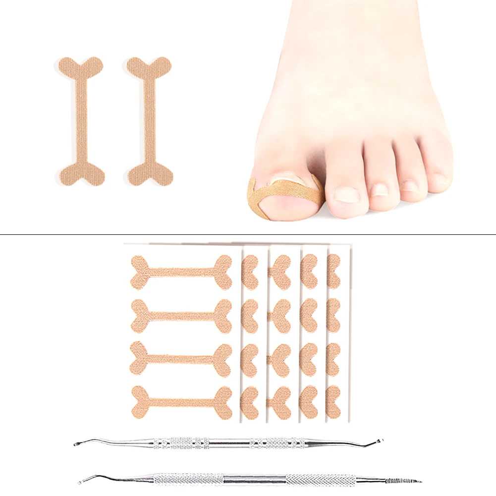

Ingrown Toenail Tools Correction Patches Lifter File Removal Professional Pedicure Nails Healthy Paronychia Treatment Recover