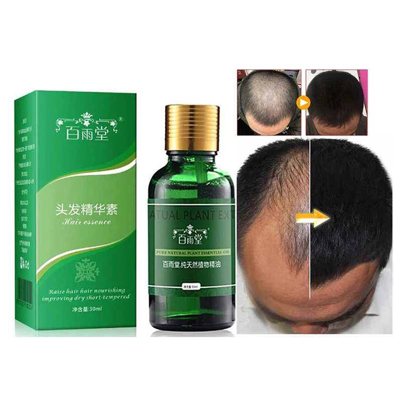 

Hair Growth Essential Oils Essence Anti Hair Loss Products Health Care Beauty Faster Grow Dense Hair Care Liquid Serum