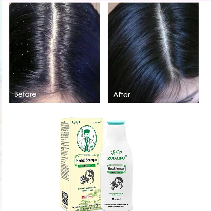 Mite Growth and Removal Care Repair Hair Antibacterial Essence Psoriasis Eczema Herbal Ginseng Treatment Shampoo 120ML | Красота и