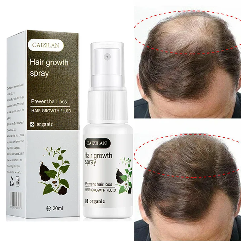 

Herb Hair Growth Spray Serum Prevent Hair Loss Products Anti Hair Loss Fast Growing Liquid Hair Scalp Treatments Men Women 20ml