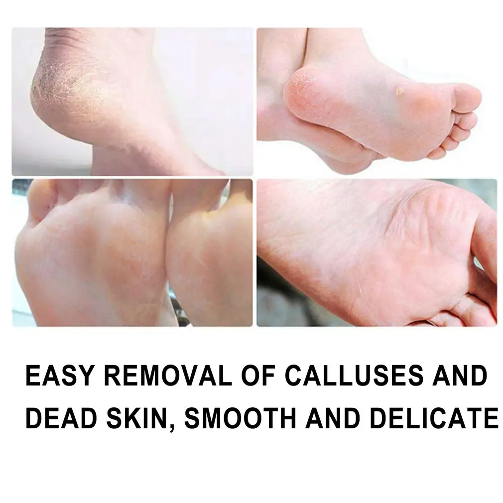 

Electric Foot File Professional Foot Care Tool Hard Skin Remover Pedicure Instrument Dermabrasion Machine