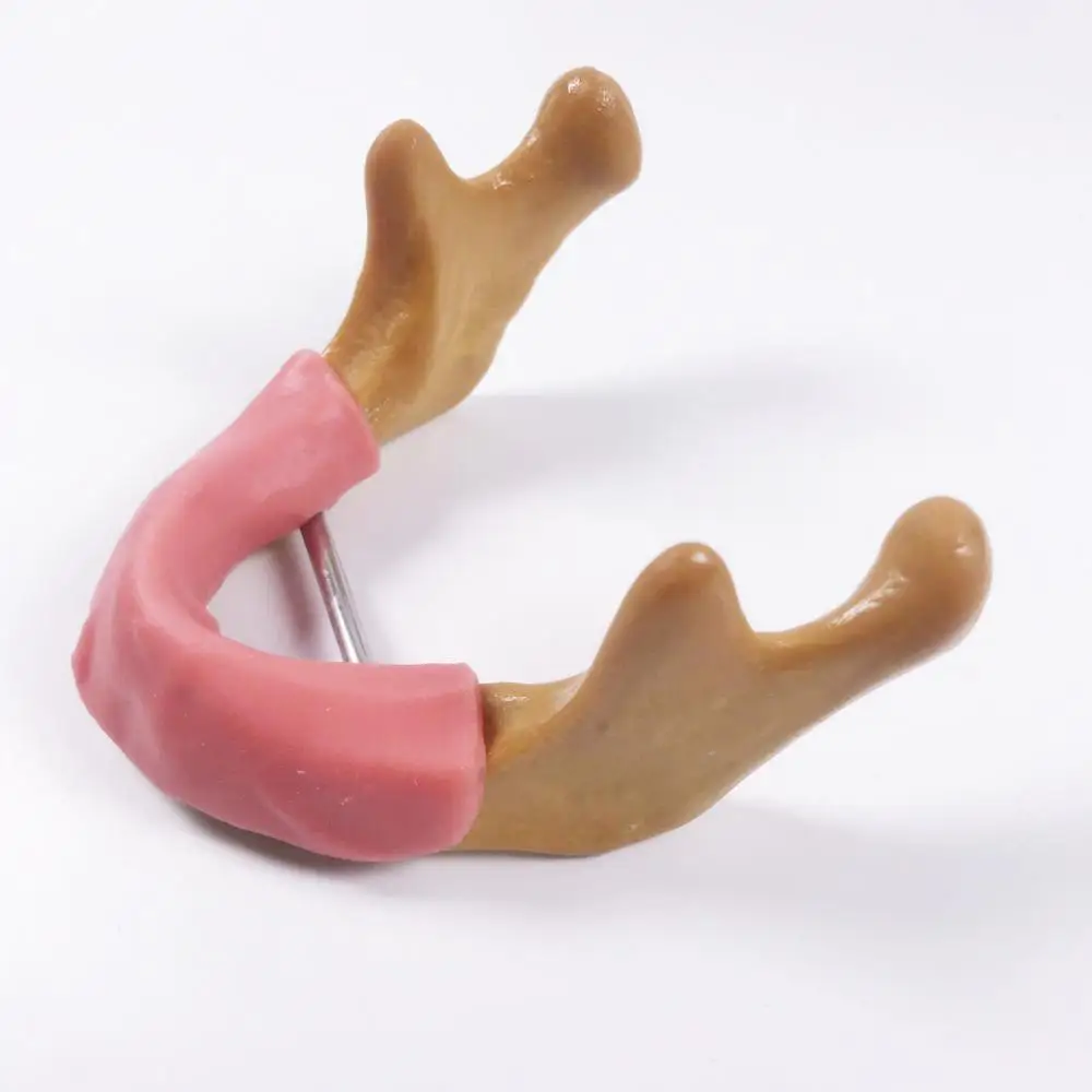 1 шт. стоматологическая обучающая модель имплантата| |