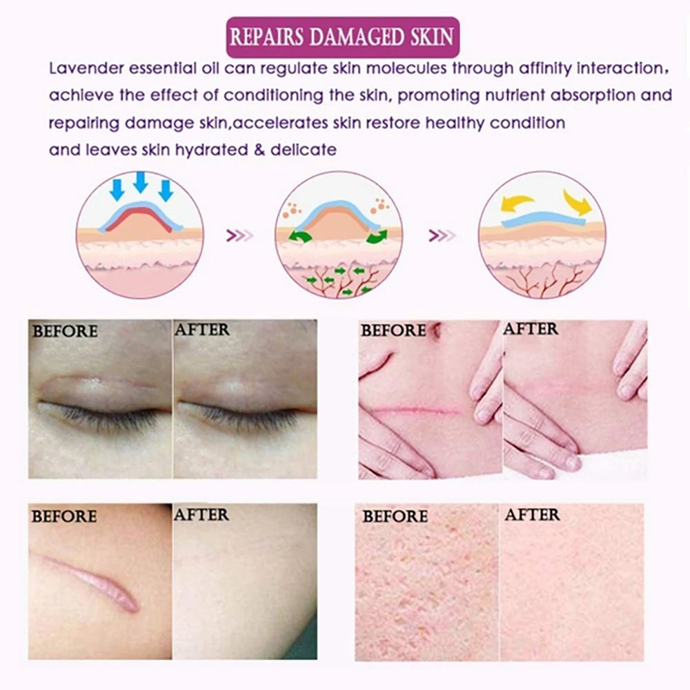 Эфирное массажное масло для удаления шрамов эссенция восстановления лаванды