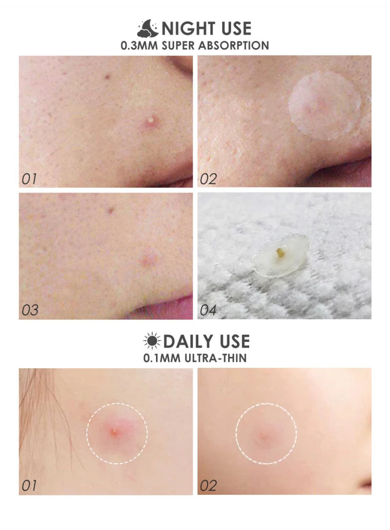 24 шт. невидимые патчи для удаления прыщей и чёрных точек |