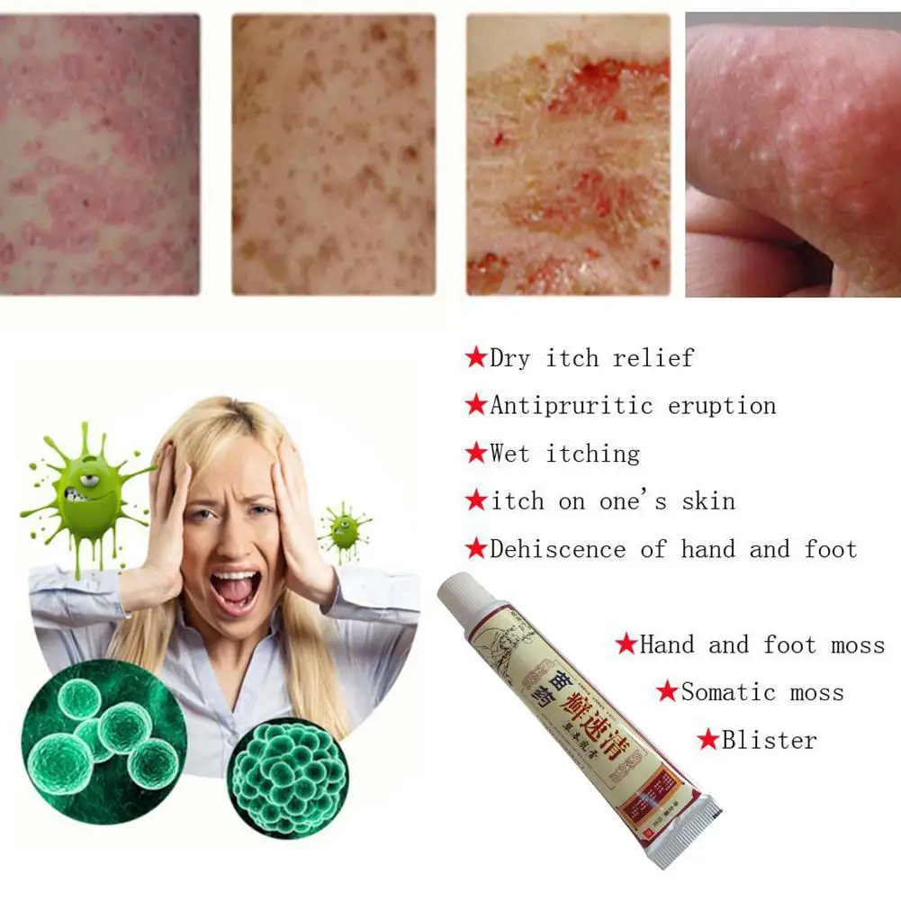 

15g Herb Psoriasis Cream Body Health Antibacterial Skin Repair Psoriasis Ointment Dermatitis Eczema Pruritus Psoriasis Plaster