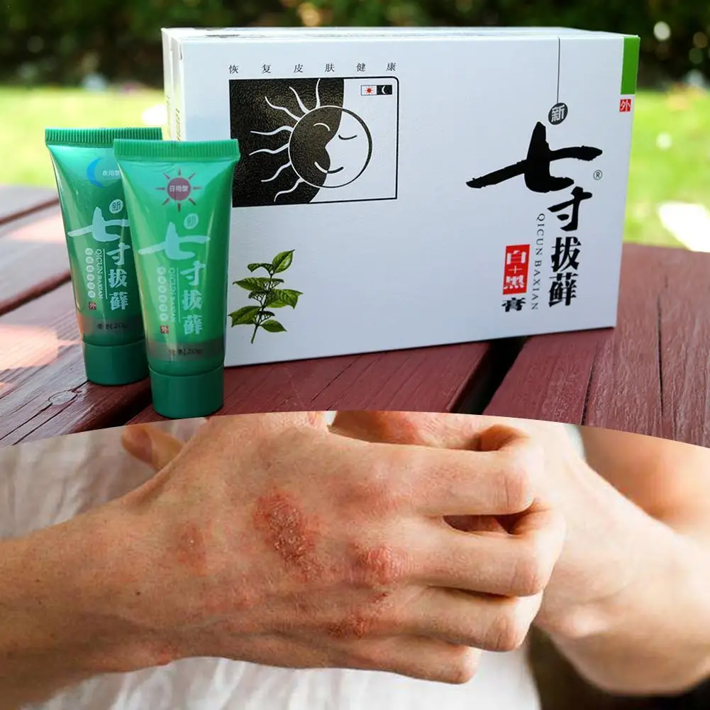 

Anti-inflammatory And Anti-itch Cream Qi Cun Moss Plucking Cream Sterilizes Eczema And Relieves Itching
