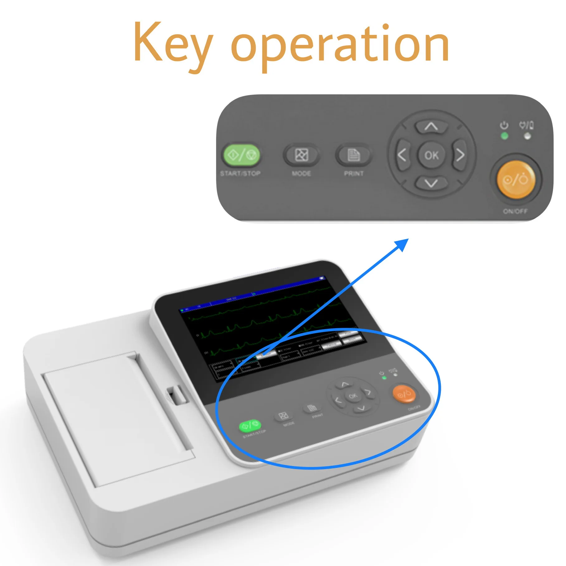 Contec Electrocardiograph E6 12-Lead ECG Time Print Powerful data management Auto-anaylsis Report |