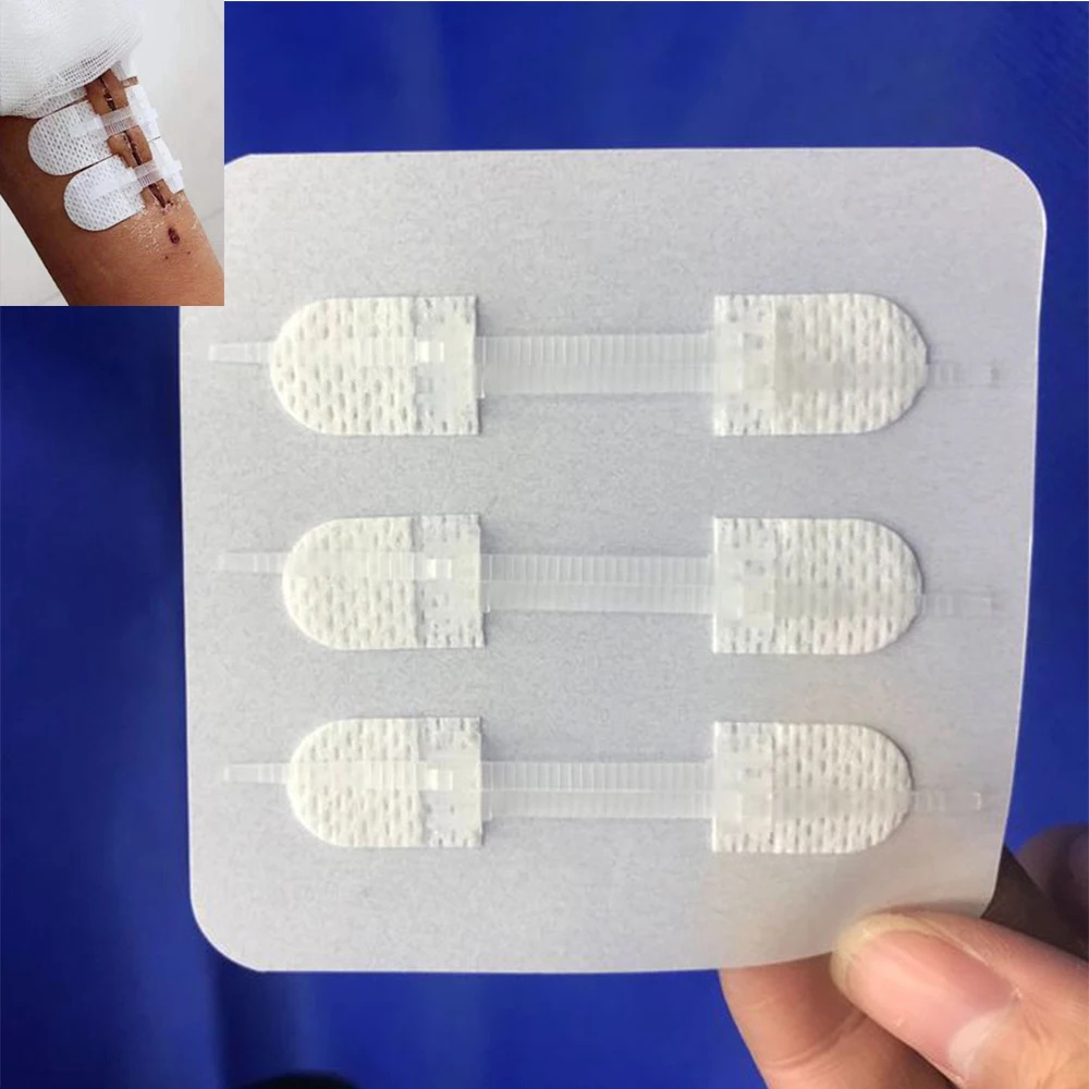 3 шт./компл. Набор для экстренных случаев гемостатический клеевой пластырь с