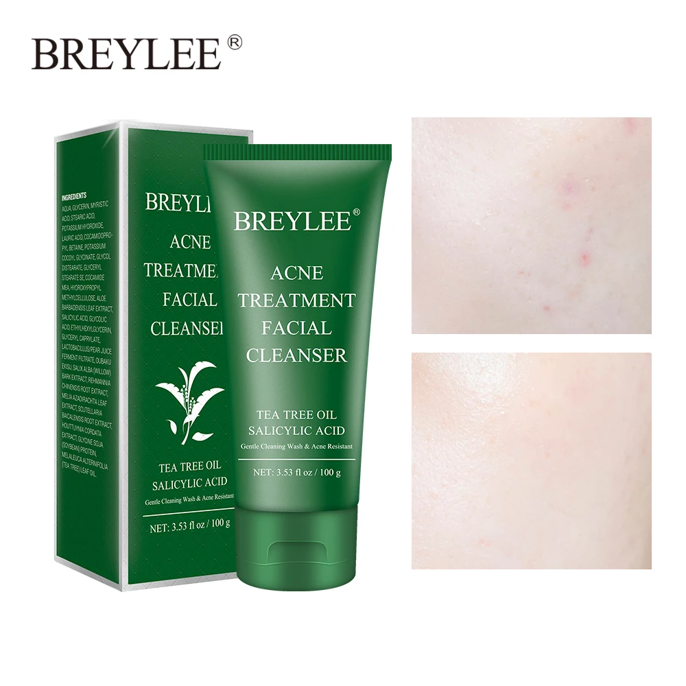 

BREYLEE Facial Acne Treatment Cleanser Remove Blackhead Cleaner Shrink Pore Oil Control Cleansing Wash Face Skin Care 100g