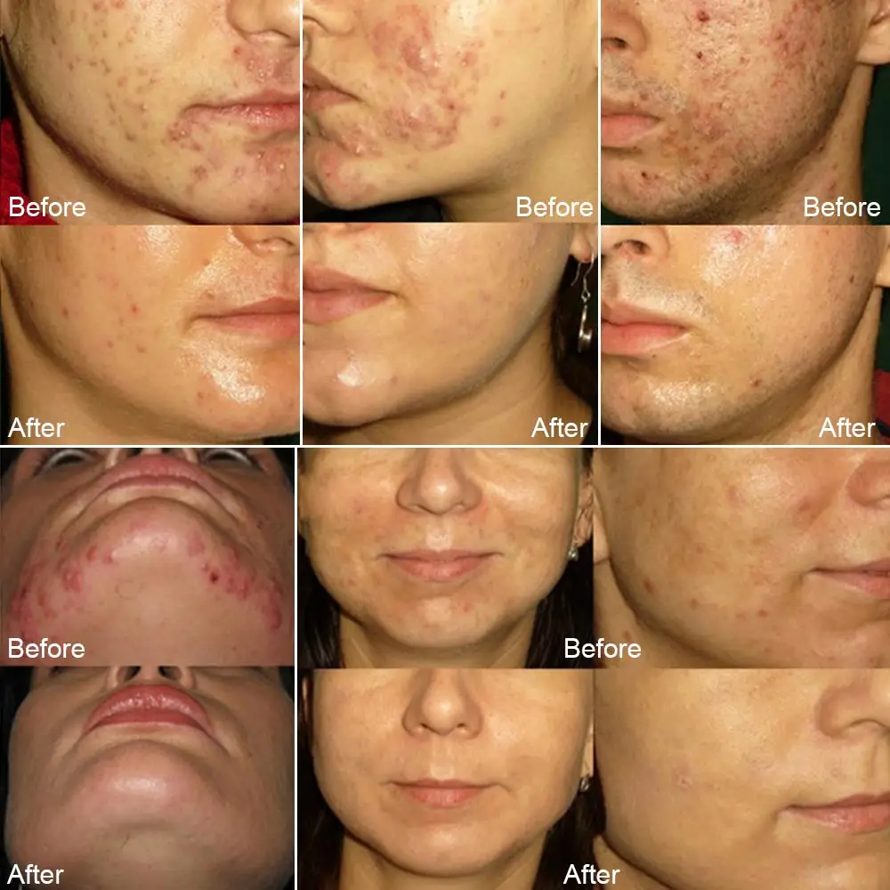 Мыло с морской солью 3 шт. мыло козьим молоком увлажняющее Отбеливающее средство