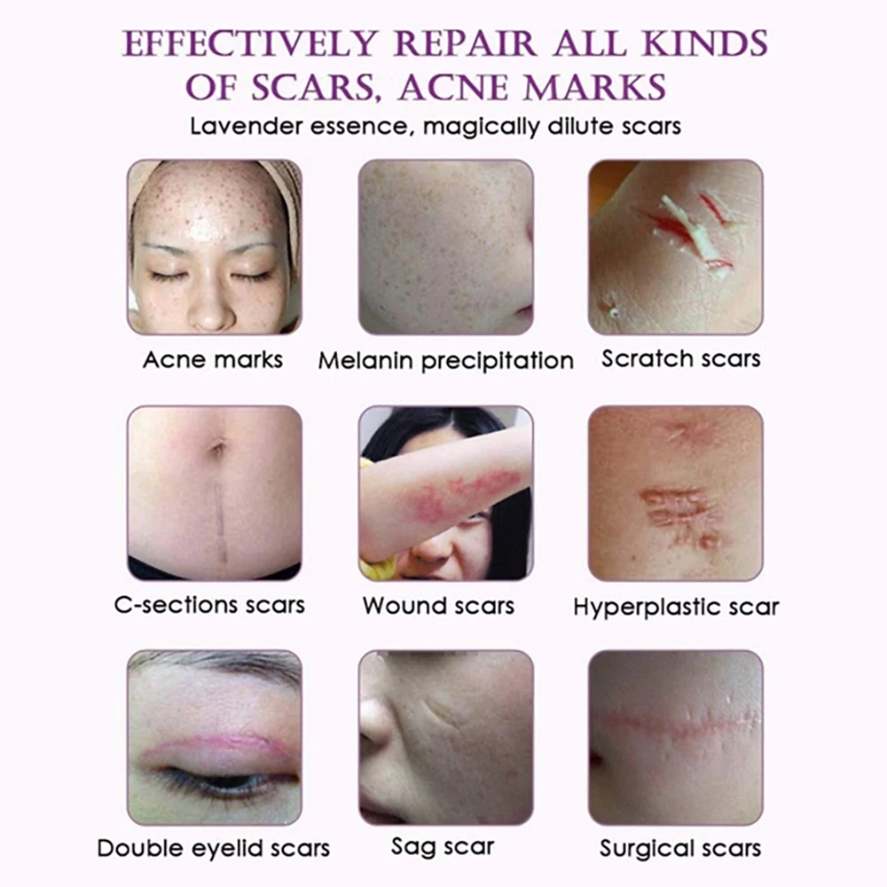 Эфирное массажное масло для удаления шрамов эссенция восстановления лаванды