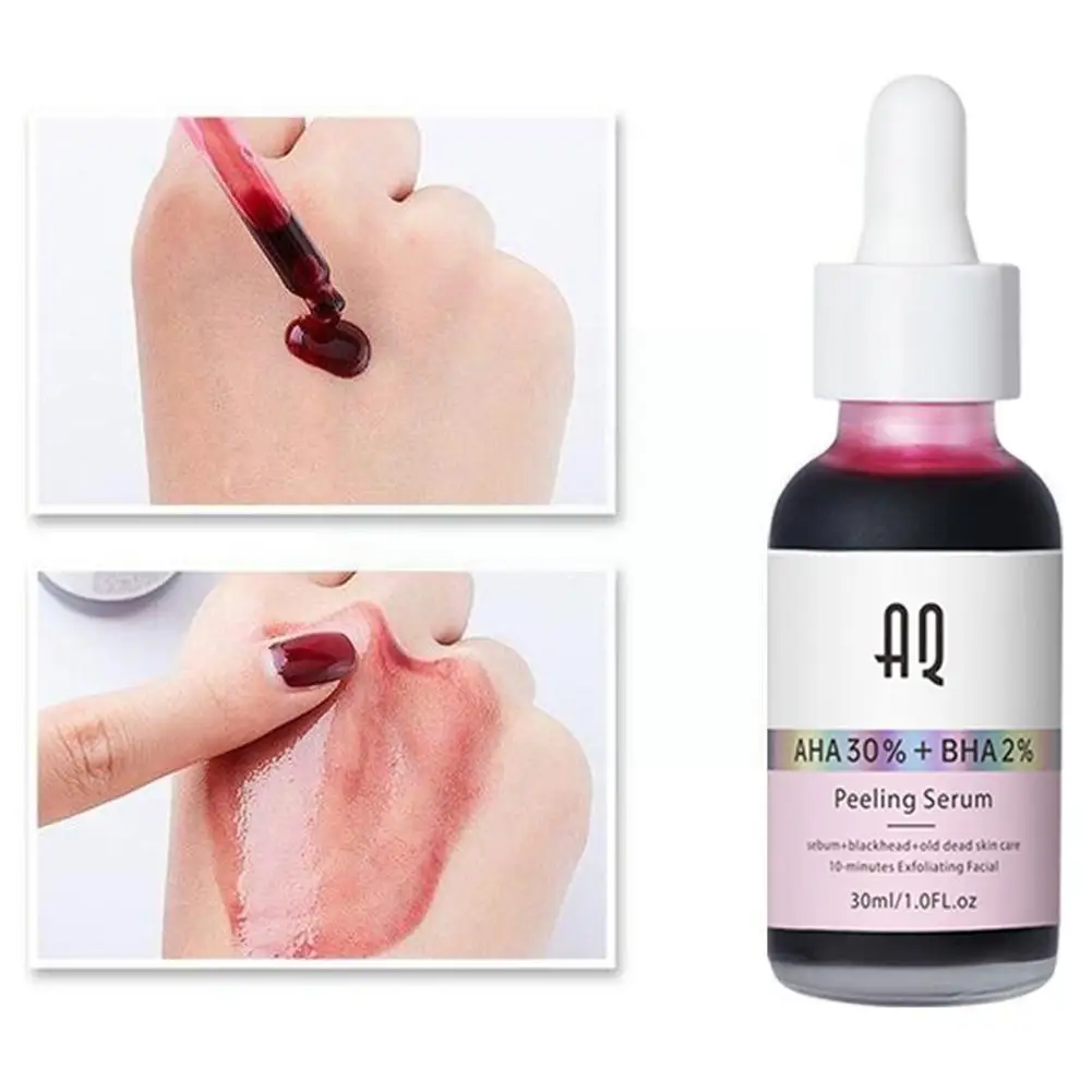 

30% Face Serum Anti-Acne Nourishing Repairing Moisturizing Smooth Anti-Aging Brighten Care Shrink Essence Pores Whitening S A3Z1