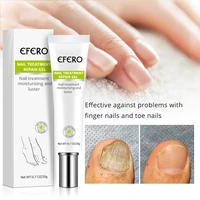 efero anti fungal nail gel anti infection nails treatment hand foot cream repair toenail remove fungus nails essence product