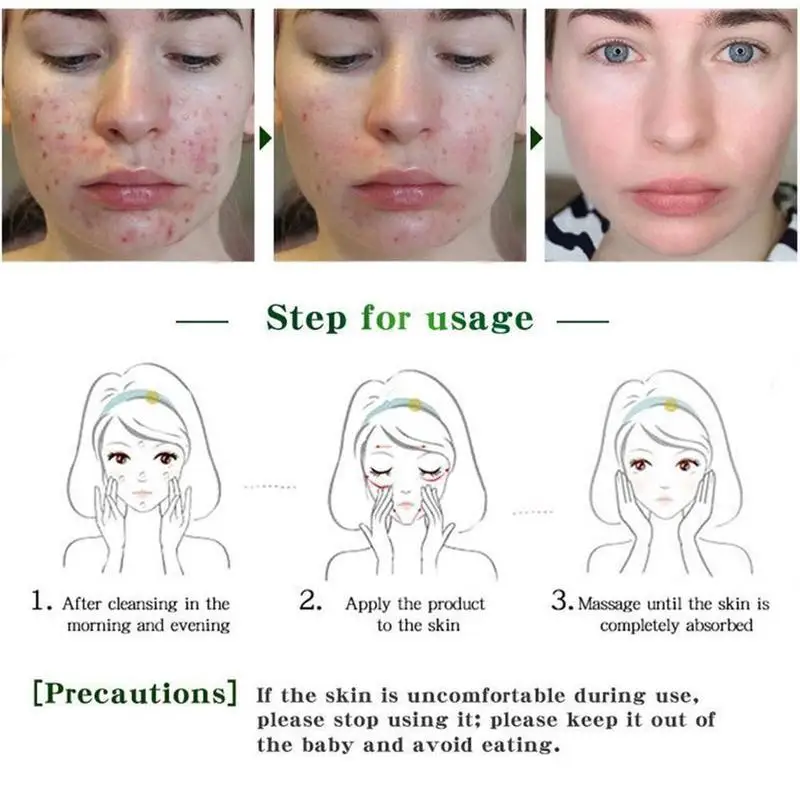 BIOAQUA Pure Skin Removal of Acne Liquid Blackhead Pimple Acne Treatment Brightening Moisturizing Oil-Control Face Serum Care