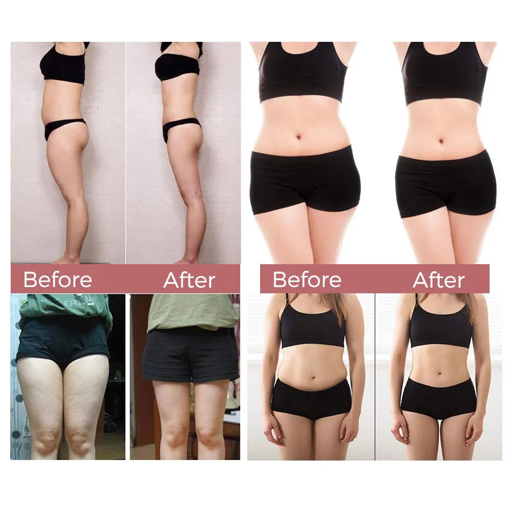 GPGP зеленый целлюлитный крем для похудения эффективный антицеллюлитный ног тела