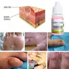 Средство для удаления бородавок на ногах MOLF, 10 мл