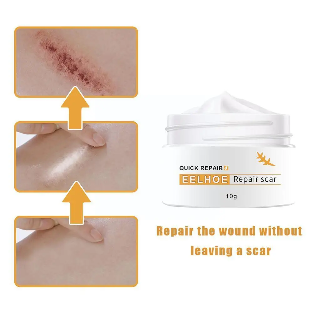 

10g Repair Scar Cream Skin Care Body Cream Stretch Marks Cream Scar Striae Scar Marks Repair Scald Fade Pregnancy Cream Rem W9I2